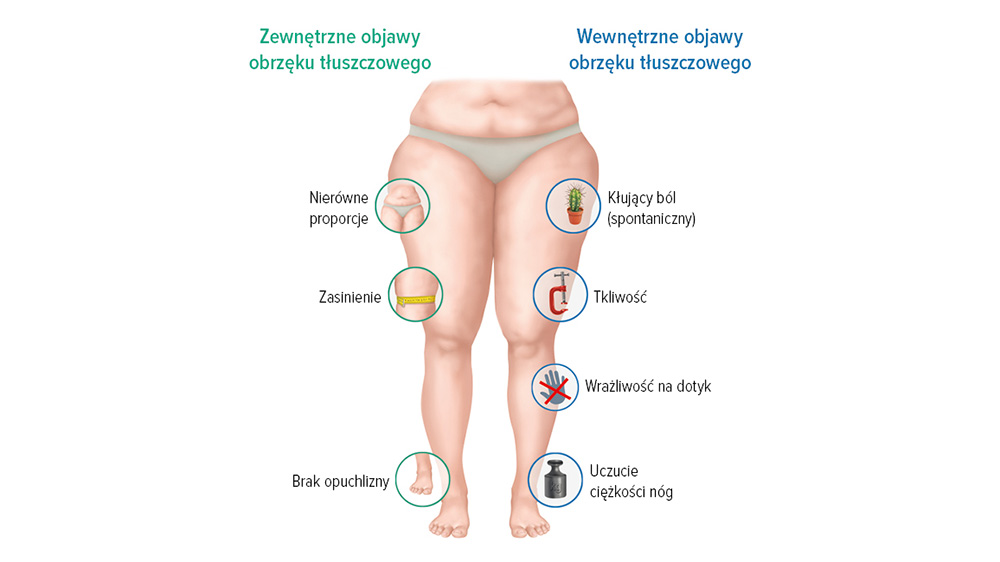 Objawy obrzęku limfatycznego